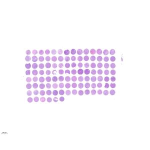 CXSQ104D-01